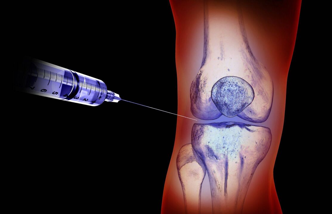 intra-articular injections for the treatment of arthrosis